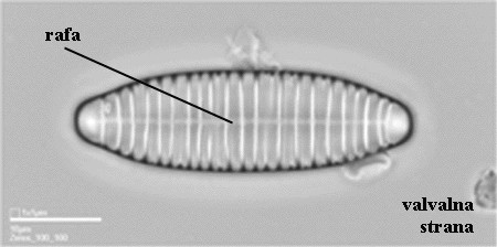 Diatoma sp. - valvalna strana