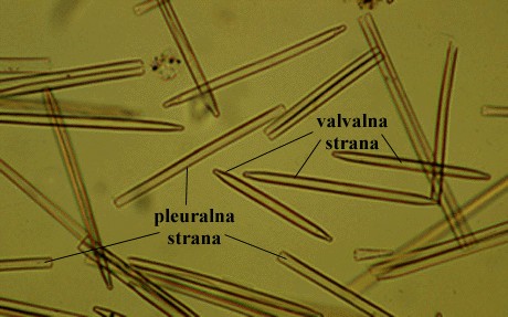 Synedra sp. - pleuralna i valvalna strana