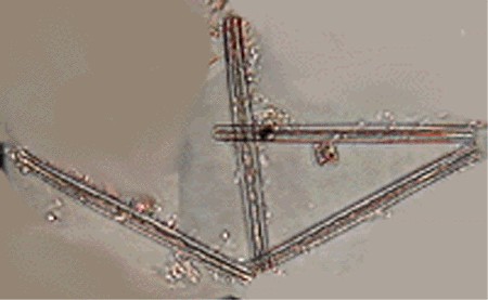 Thalassiothrix sp. - pleuralna i valvalna strana