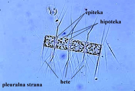 Chaetoceras sp. - slika 1