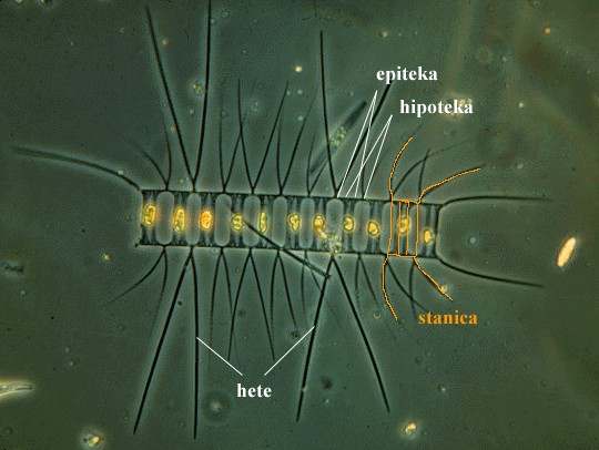 Chaetoceras sp. - slika 2