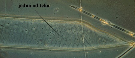 Rhizosolenia sp. - slika 1